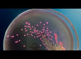 Antimicrobial product efficacy testing