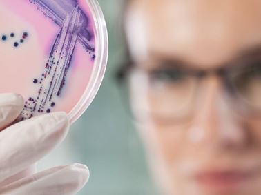 Pharmaceutical CMC Product Development Microbiological